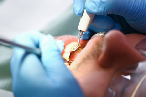 Best Emergency Tooth Extraction in Teaticket, MA