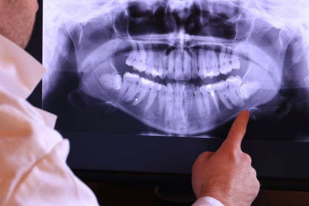 Best Emergency Gum Treatment in Teaticket, MA