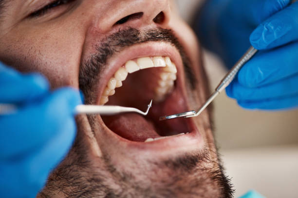 Best Emergency Denture Repair in Teaticket, MA
